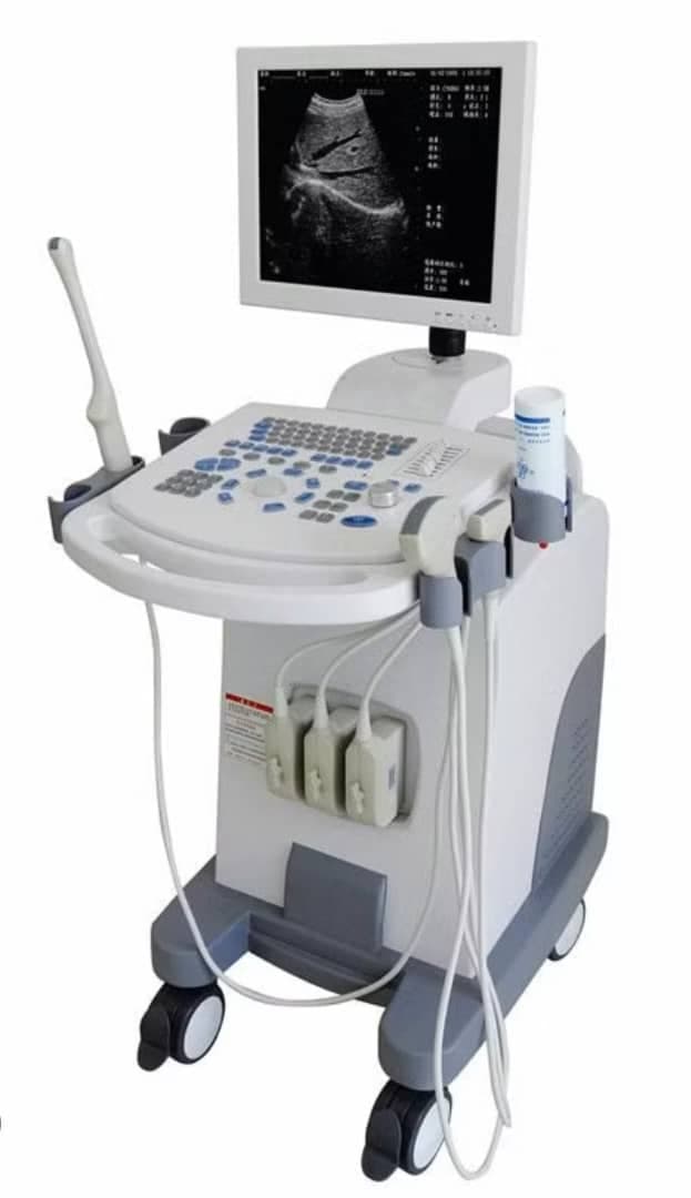 Digital Ultrasound Scanners